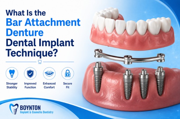 Den3 What Is the Bar Attachment Denture Dental Implant Technique?