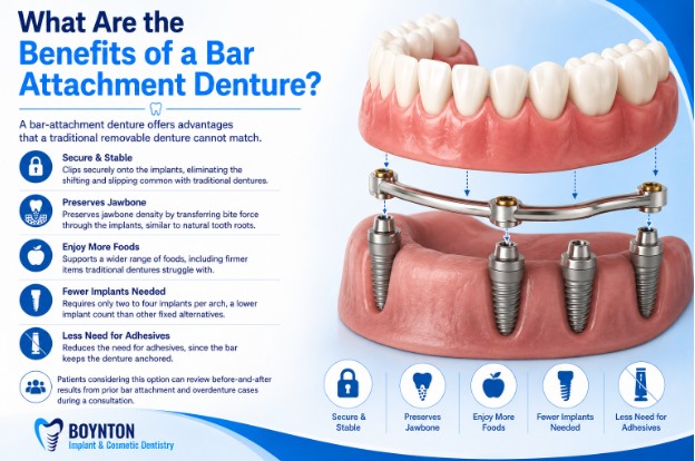 Den5 What Are the Benefits of a Bar Attachment Denture?
