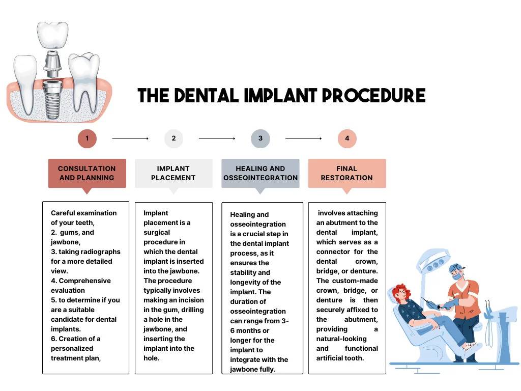 Flow Chart Dental implants