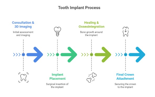 De4 What Does The Tooth Implant Process Look Like?