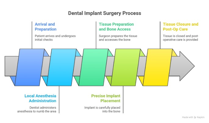Den3 What Happens During Dental Implant Surgery