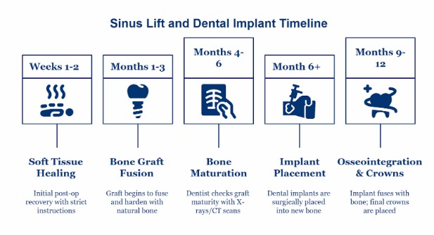 Den3 Healing Time and Implant Timeline After a Sinus Lift