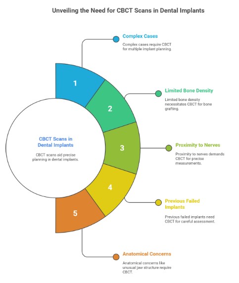 D4 When A CBCT Scan Is Recommended For Dental Implants (And When It May Not Be Needed)